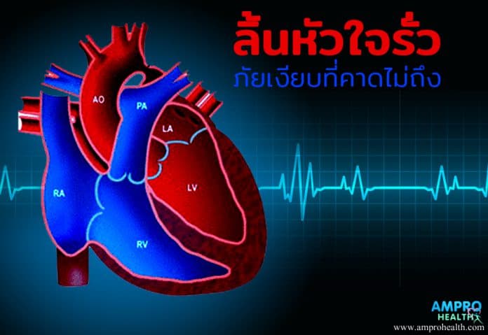 ลิ้นหัวใจรั่ว ( Heart Valve Regurgitation ) เป็นอย่างไร