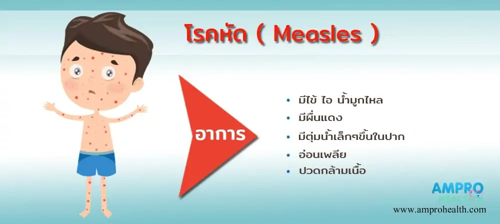 โรคหัด ( Measles ) เกิดได้กับใครบ้าง ?