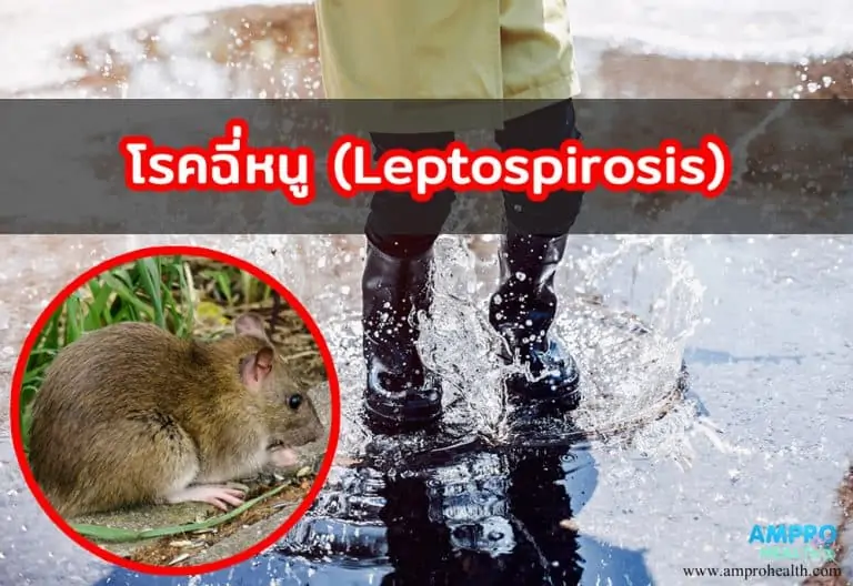 โรคฉี่หนู ( Leptospirosis ) ภัยเงียบที่มากับหน้าฝนและน้ำท่วม