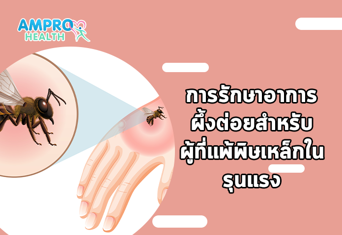 การรักษาอาการผึ้งต่อยสำหรับผู้ที่แพ้พิษเหล็กในรุนแรง