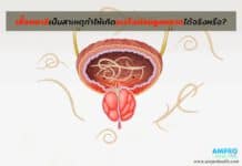 เชื้อพยาธิเป็นสาเหตุทำให้เกิดมะเร็งต่อมลูกหมากได้ พยาธิ