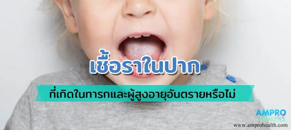 เชื้อราในปาก ที่เกิดในทารกและผู้สูงอายุอันตรายหรือไม่