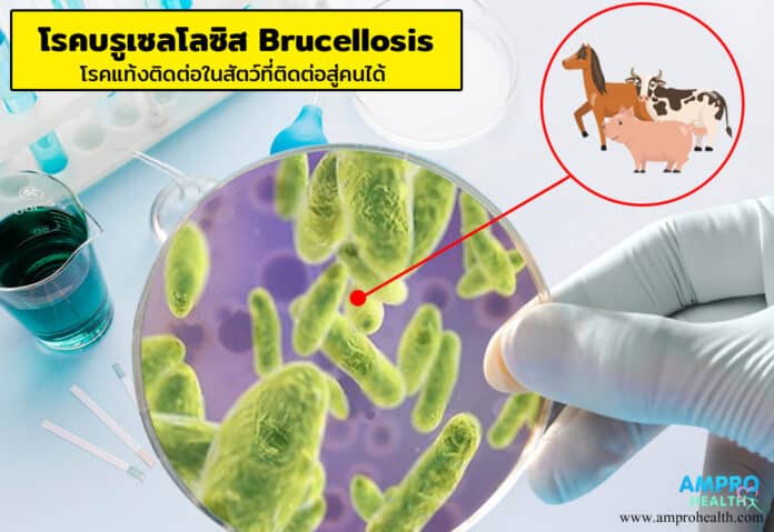 โรคบรูเซลโลซิส Brucellosis