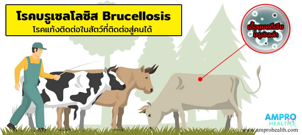 โรคบรูเซลโลซิส Brucellosis