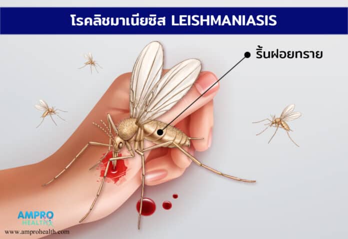 โรคลิชมาเนีย ( Leishmaniasis )