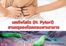 เอชไพโลไร (H. Pylori ) สาเหตุของโรคกระเพาะอาหาร เอชไพโลไร (H. Pylori ) สาเหตุของโรคกระเพาะอาหาร