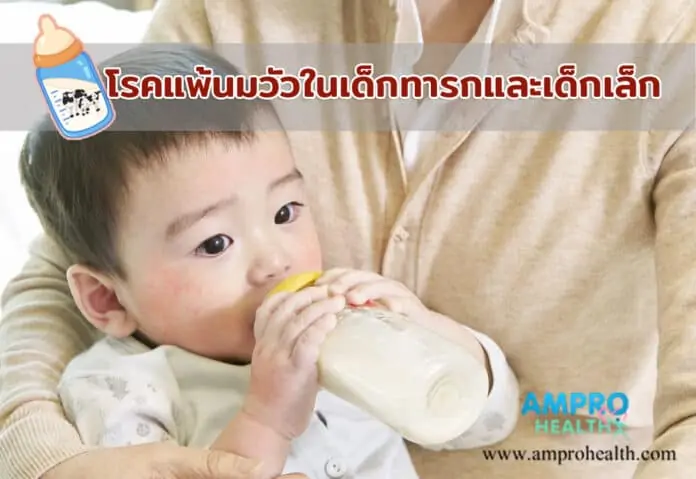 โรคแพ้นมวัวในเด็กทารกและเด็กเล็ก