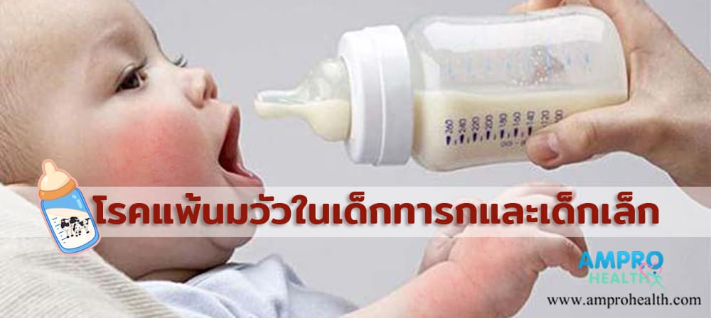 โรคแพ้นมวัวในเด็กทารกและเด็กเล็ก