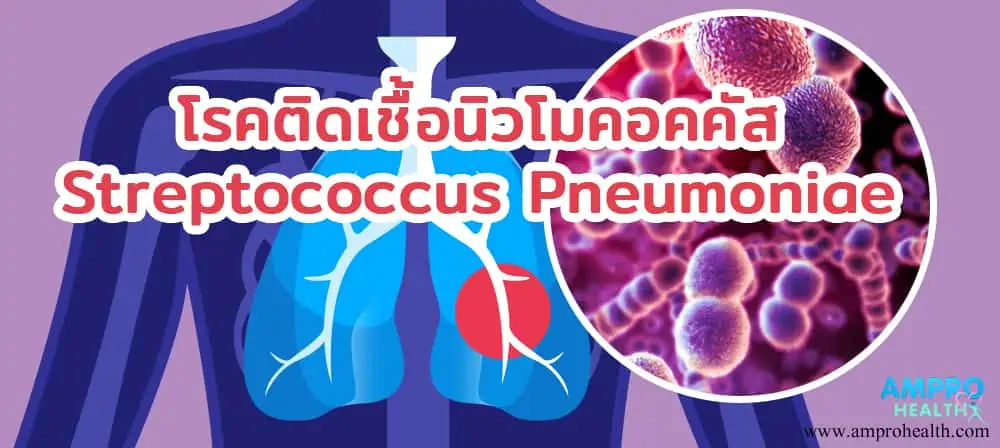 โรคติดเชื้อนิวโมคอคคัส Streptococcus Pneumoniae
