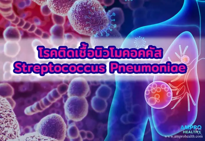 โรคติดเชื้อนิวโมคอคคัส Streptococcus Pneumoniae