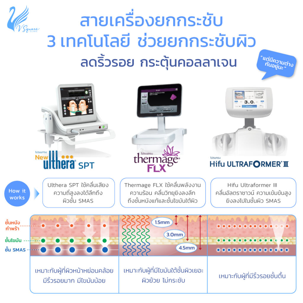 Ultraformer III / Ulthera / Thermage