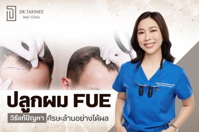 ปลูกผม FUE ราคา