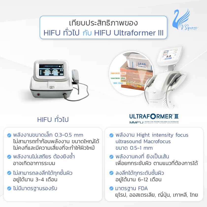 Ultraformer III ต่างจาก Hifu รุ่นอื่นอย่างไร