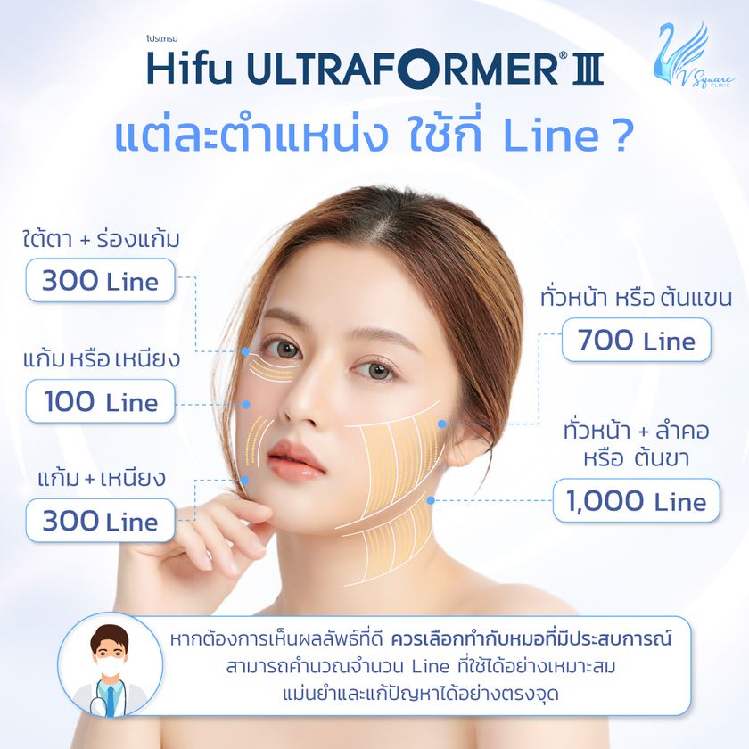 Ultraformer III ทำตำแหน่งไหนได้บ้าง